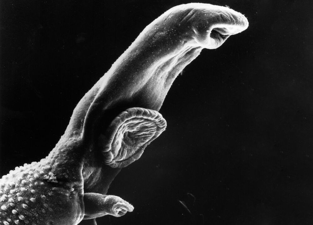 Schistosoma yra parazitas, kurio gyvenimo ciklui reikalingas tarpinis šeimininkas. 