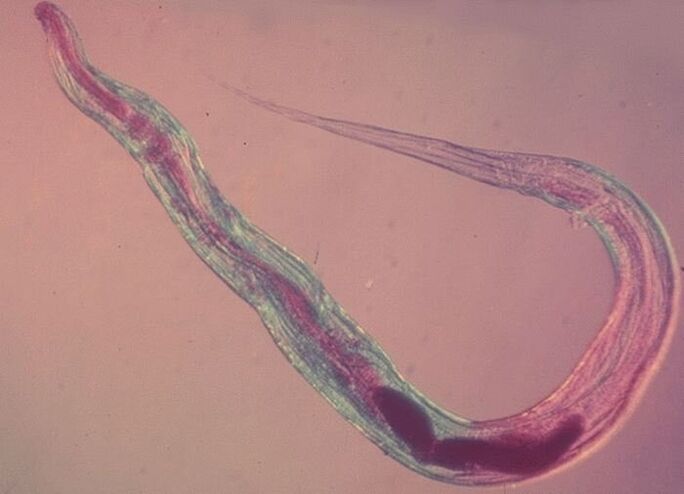 Pinworm po mikroskopu